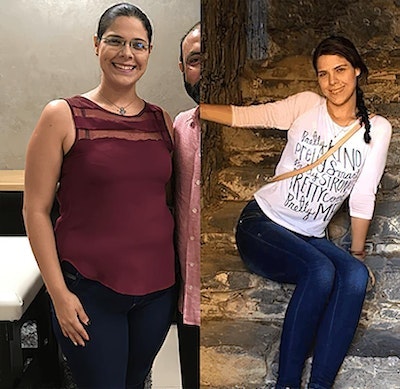 Before and after bariatric surgery